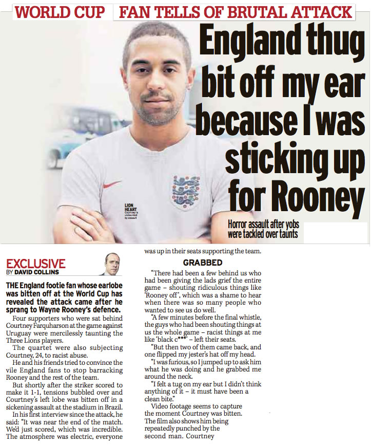 England thug bit off my ear - Daily Mirror